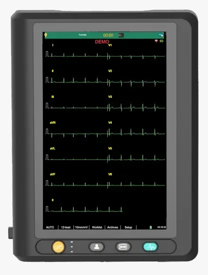 ECG-301 12 KANALLI EKG CİHAZI 6