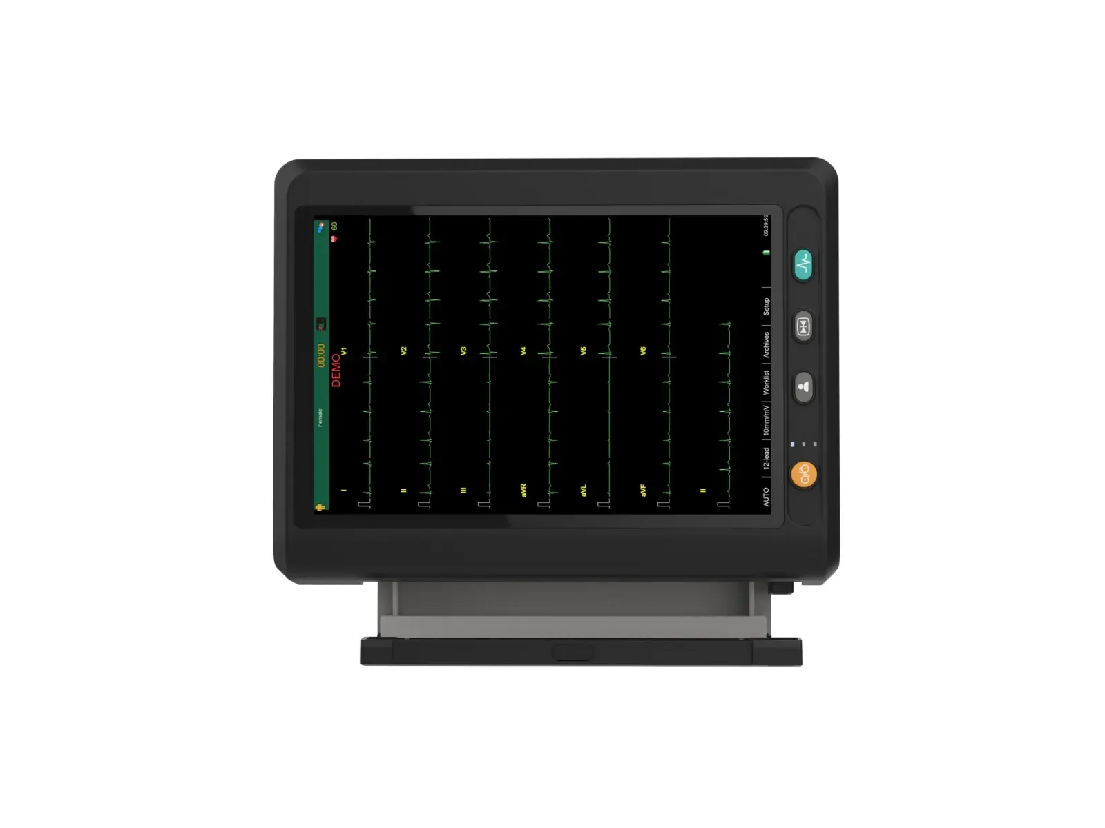 ECG-301 12 KANALLI EKG CİHAZI 4