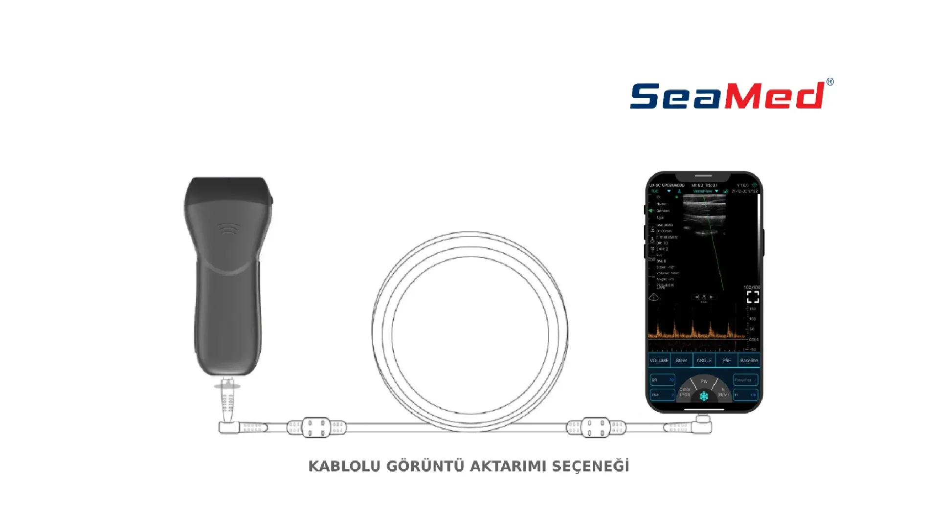 KONTED KONVEKS EL TİPİ KABLOSUZ ULTRASON 4