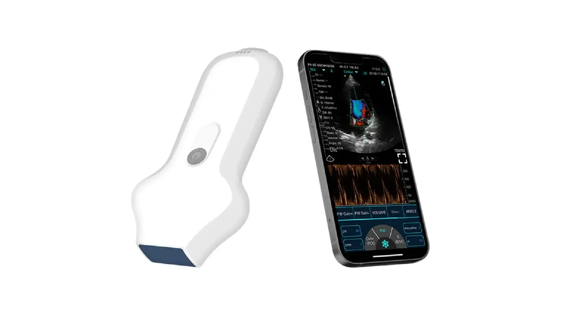 KONTED KARDİYAK EL TİPİ KABLOSUZ ULTRASON 5