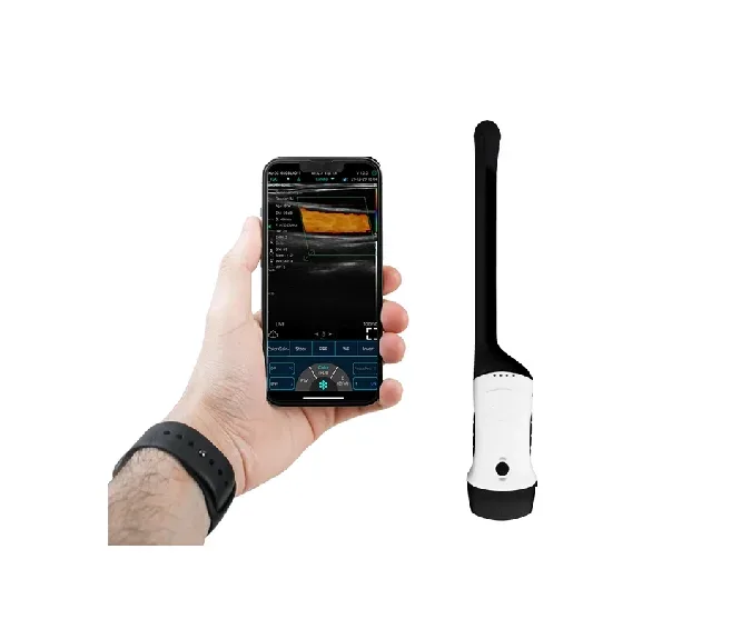 CONTED CONVEX + TRANSVAGINAL HAND-HOLD WIRELESS ULTRASOUND 4