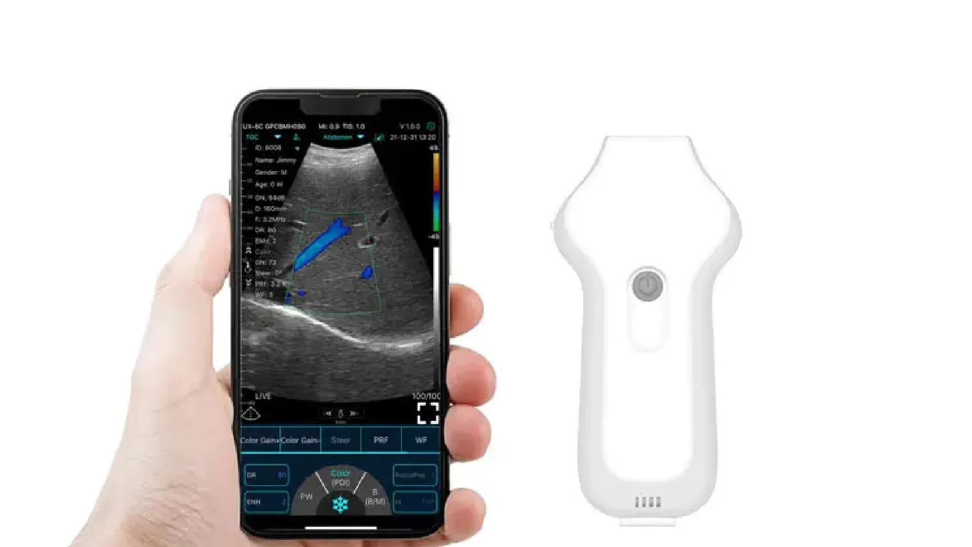 KONTED KARDİYAK EL TİPİ KABLOSUZ ULTRASON 3