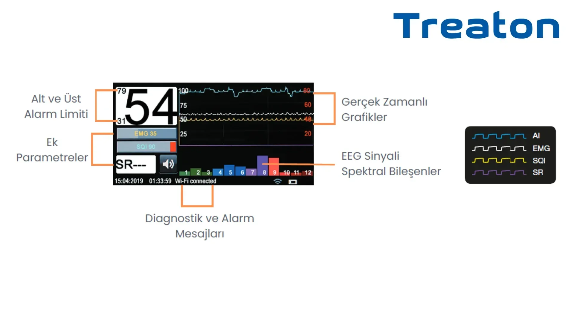 MGA-06 ANESTEZİ DERİNLİK MONİTÖRÜ (BIS MONİTÖRÜ) 5