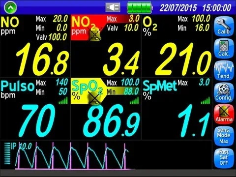 Nitrik Oksit Monitörü 4